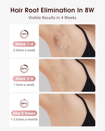IPL Hair Removal Handset